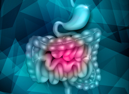 Image of Carcinoid Syndrome Image