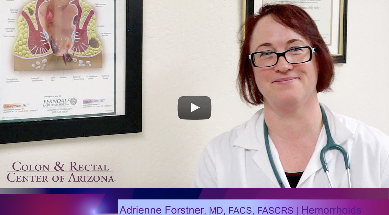 Hemorrhoids thumbnail video image